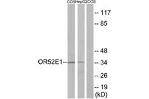 Western blot analysis of extracts from COS7/HepG2 cells, using OR52E1 Antibody.