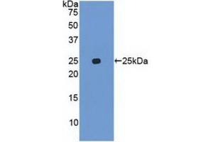 Detection of Recombinant UBD, Human using Polyclonal Antibody to Ubiquitin D (UBD) (UBD anticorps  (AA 1-165))