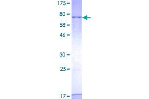 Image no. 2 for serine/threonine Kinase 25 (STK25) (AA 1-426) protein (GST tag) (ABIN1321671)