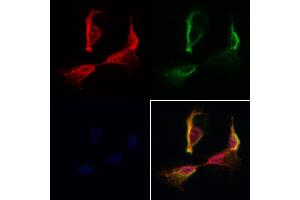 ABIN7093908 and ABIN7097952 staining Hela cells by IF/ICC. (SSFA2 anticorps  (C-Term))