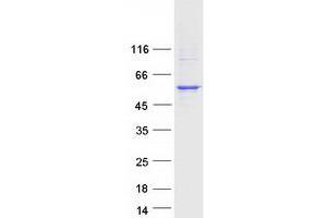 Validation with Western Blot