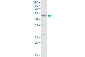 CAT MaxPab rabbit polyclonal antibody. (Catalase anticorps  (AA 1-527))