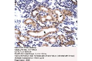 Human kidney (TRIM3 anticorps  (N-Term))