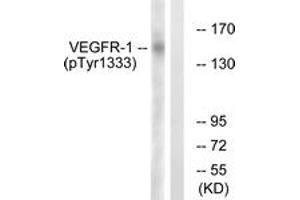 Western blot analysis of extracts from K562 cells treated with etoposide 25uM 24h, using VEGFR1 (Phospho-Tyr1333) Antibody. (FLT1 anticorps  (pTyr1333))