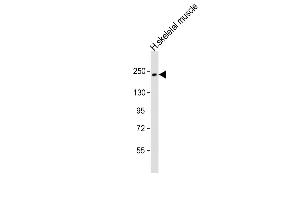 Anti-MYH7 Antibody (N-term) at 1:1000 dilution + human skeletal muscle lysate Lysates/proteins at 20 μg per lane. (MYH7 anticorps  (N-Term))