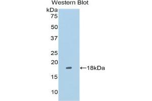 Western blot analysis of the recombinant protein. (LRRFIP1 anticorps  (AA 128-250))