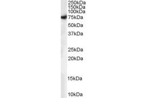 ABIN185107 (0. (STXBP1 anticorps  (C-Term))