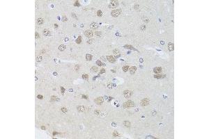 Immunohistochemistry of paraffin-embedded rat brain using PPP1CC antibody.