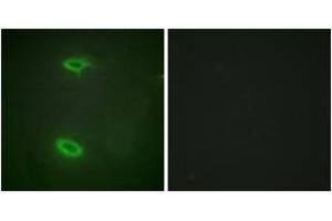 Immunofluorescence analysis of HeLa cells, using DLGP1 Antibody. (DLGAP1 anticorps  (AA 791-840))