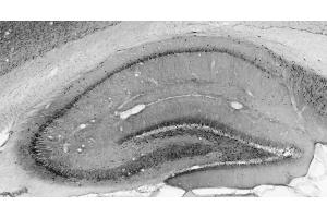 Adult rat hippocampus immunohistochemistry.