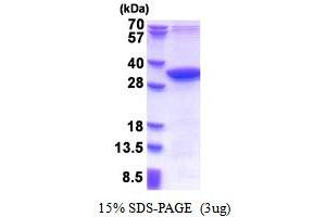 SDS-PAGE (SDS) image for Methylmalonic Aciduria (Cobalamin Deficiency) CblD Type, with Homocystinuria (MMADHC) (AA 39-296) protein (His tag) (ABIN5853506) (MMADHC Protein (AA 39-296) (His tag))