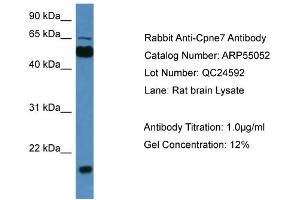 WB Suggested Anti-Cpne7  Antibody Titration: 0. (CPNE7 anticorps  (C-Term))