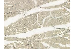 ABIN6259225 and ABIN6273402 at 1/100 staining human tongue carcinoma by IHC-P. (TCAP anticorps  (N-Term))