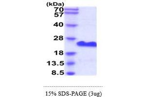 SDS-PAGE (SDS) image for Membrane-Spanning 4-Domains, Subfamily A, Member 1 (MS4A1) (AA 210-297) protein (His tag) (ABIN6388166)