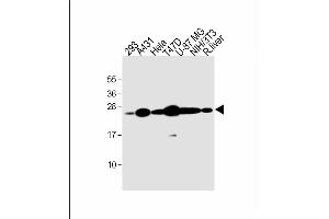 All lanes : Anti-RAB1B Antibody (C-term) at 1:2000 dilution Lane 1: 293 whole cell lysate Lane 2: A431 whole cell lysate Lane 3: Hela whole cell lysate Lane 4: T47D whole cell lysate Lane 5: U-87 MG whole cell lysate Lane 6: NIH/3T3 whole cell lysate Lane 7: rat liver lysate Lysates/proteins at 20 μg per lane. (RAB1B anticorps  (C-Term))