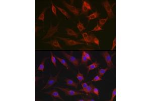 anti-Chemokine (C-X3-C Motif) Ligand 1 (CX3CL1) (AA 365-397) antibody