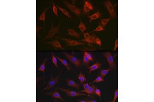 Immunofluorescence analysis of NIH-3T3 cells using CX3CL1 Rabbit pAb (ABIN6129035, ABIN6139265, ABIN6139266 and ABIN6218481) at dilution of 1:100 (40x lens). (CX3CL1 anticorps  (AA 365-397))