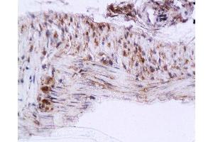 Formalin-fixed and paraffin embedded rat colon tissue labeled with Anti-Cygb Polyclonal Antibody , Unconjugated at 1:200, followed by conjugation to the secondary antibody and DAB staining