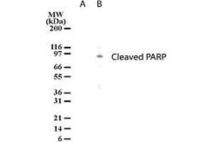 Image no. 1 for anti-Poly (ADP-Ribose) Polymerase 1 (PARP1) antibody (ABIN207909) (PARP1 anticorps)