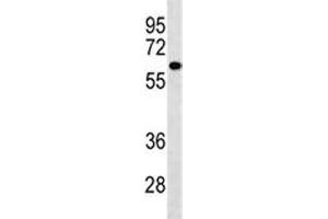 PIGS antibody western blot analysis in A549 lysate.