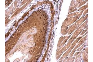 IHC-P Image Monoglyceride lipase antibody detects Monoglyceride lipase protein at nucleus on mouse esophagus by immunohistochemical analysis. (MGLL anticorps)