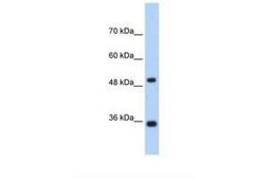 anti-Fructose-1,6-Bisphosphatase 1 (FBP1) (AA 114-163) antibody