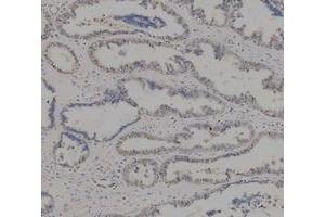 IHC analysis of ADK using anti-ADK antibody (ABIN4886430). (ADK anticorps  (AA 165-351))