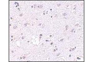 Immunohistochemistry of LASS5 in human brain tissue with this product at 2. (LASS5 anticorps  (N-Term))