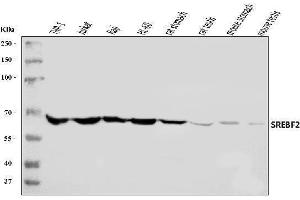 Western blot analysis of SREBP2/SREBF2 using anti-SREBP2/SREBF2 antibody (ABIN7601523).