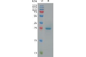 Cynomolgus A1 Protein, His Tag on SDS-PAGE under reducing condition.