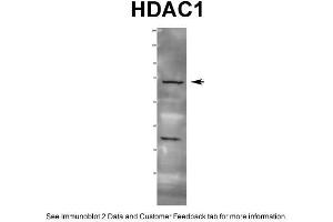 WB Suggested Anti-HDAC1 Antibody  Titration: 1 ug/ml Positive Control: Rat tissue (HDAC1 anticorps  (C-Term))