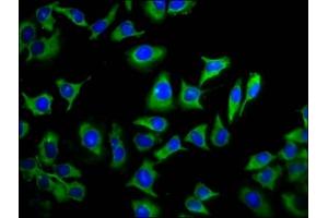 Immunofluorescence staining of A549 cells with ABIN7173285 at 1:133, counter-stained with DAPI. (TMEM88 anticorps  (AA 109-159))