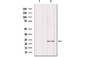 Western blot analysis of extracts from Hela, using RGS1 Antibody. (RGS1 anticorps  (Internal Region))