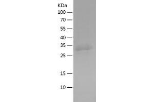 Western Blotting (WB) image for EH-Domain Containing 1 (EHD1) (AA 265-317) protein (His-IF2DI Tag) (ABIN7122750)