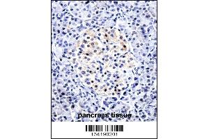 CCL15 Antibody immunohistochemistry analysis in formalin fixed and paraffin embedded human pancreas tissue followed by peroxidase conjugation of the secondary antibody and DAB staining. (CCL15 anticorps  (C-Term))