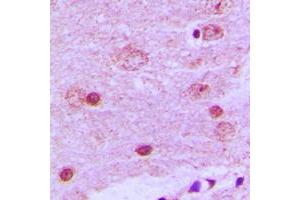 Immunohistochemical analysis of PAK7 staining in human brain formalin fixed paraffin embedded tissue section. (PAK7 anticorps  (C-Term))