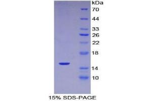 SDS-PAGE analysis of Mouse Complement 1 Inhibitor Protein. (SERPING1 Protéine)