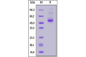 Biotinylated Human IL-13 R alpha 2, His,Avitag on  under reducing (R) condition.