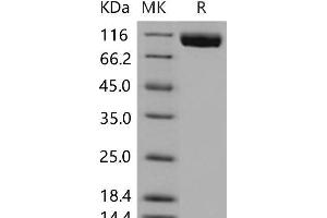 Western Blotting (WB) image for Fms-Related Tyrosine Kinase 4 (FLT4) (Active) protein (His tag) (ABIN7195831)