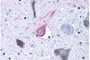 Anti-GPR50 antibody IHC staining of human brain, substantia nigra.