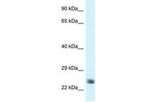 Image no. 1 for anti-NADH Dehydrogenase (Ubiquinone) Fe-S Protein 8, 23kDa (NADH-Coenzyme Q Reductase) (NDUFS8) (AA 114-163) antibody (ABIN6747459) (NDUFS8 anticorps  (AA 114-163))