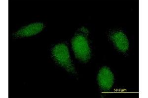 Immunofluorescence of monoclonal antibody to TTN on HeLa cell. (Titin anticorps  (AA 1-110))