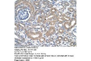 Rabbit Anti-SLC12A1 Antibody  Paraffin Embedded Tissue: Human Kidney Cellular Data: Epithelial cells of renal tubule Antibody Concentration: 4.