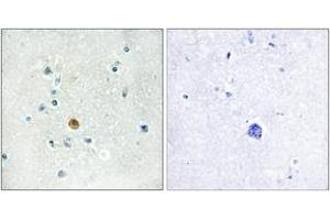 Immunohistochemistry analysis of paraffin-embedded human brain tissue, using IRF3 (Ab-396) Antibody. (IRF3 anticorps  (AA 362-411))