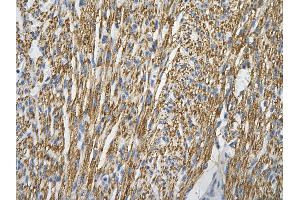 Rabbit Anti-COX4I1 Antibody       Paraffin Embedded Tissue:  Human cardiac cell   Cellular Data:  Epithelial cells of renal tubule  Antibody Concentration:   4.