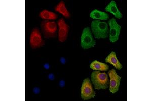 ABIN6262800 and ABIN6273259 staining Hela cells by IF/ICC. (KIDINS220 anticorps  (Internal Region))