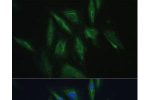 Immunofluorescence analysis of H9C2 cells using SRPRB Polyclonal Antibody at dilution of 1:100.