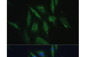 Immunofluorescence analysis of H9C2 cells using SRPRB Polyclonal Antibody at dilution of 1:100. (SRPRB anticorps)