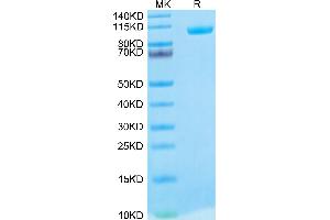Biotinylated Human MMP-9 on Tris-Bis PAGE under reduced condition.