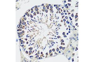 Immunohistochemistry of paraffin-embedded mouse testis using CCDC124 antibody  at dilution of 1:100 (40x lens). (CCDC124 anticorps  (AA 1-223))